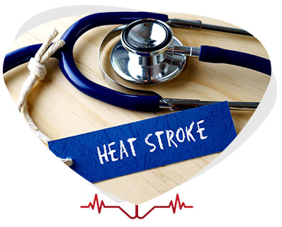 Heat Stroke Treatment Near Me in Alexandria, VA and Ruther Glen, VA