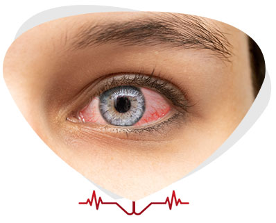 Pink Eye Treatment Near Me in Alexandria, VA and Ruther Glen, VA