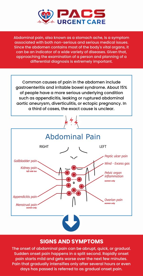 At PACS Urgent Care, our doctors, Dr. Walid Hammad and his team, can assess your abdominal pain, no matter how mild or severe, to determine the best course of treatment. Abdominal pain can be caused by many factors, including diarrhea, appendicitis, food poisoning, acid reflux, menstruation, and urine infection. For more information, contact us today or simply visit us. We have convenient locations to serve you in Alexandria VA, and Ruther Glen VA!