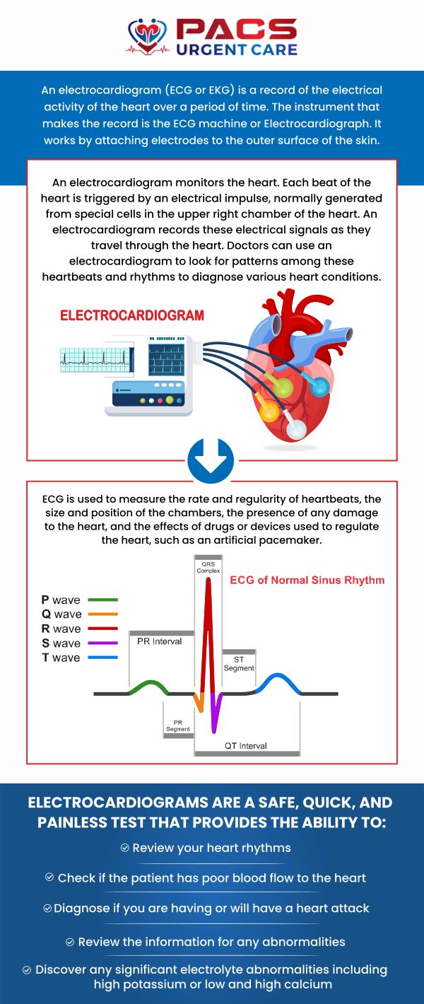 EKG helps in monitoring the health of the heart and also gives you a heads-up if something is wrong. Dr. Khaled Said MD, and Dr. Walid Hammad offer EKG services at PACS Urgent Care. If you would like to know more about the EKG services we offer, contact us today or online check-in! We have convenient locations to serve you in Ruther Glen VA, and Alexandria VA. 