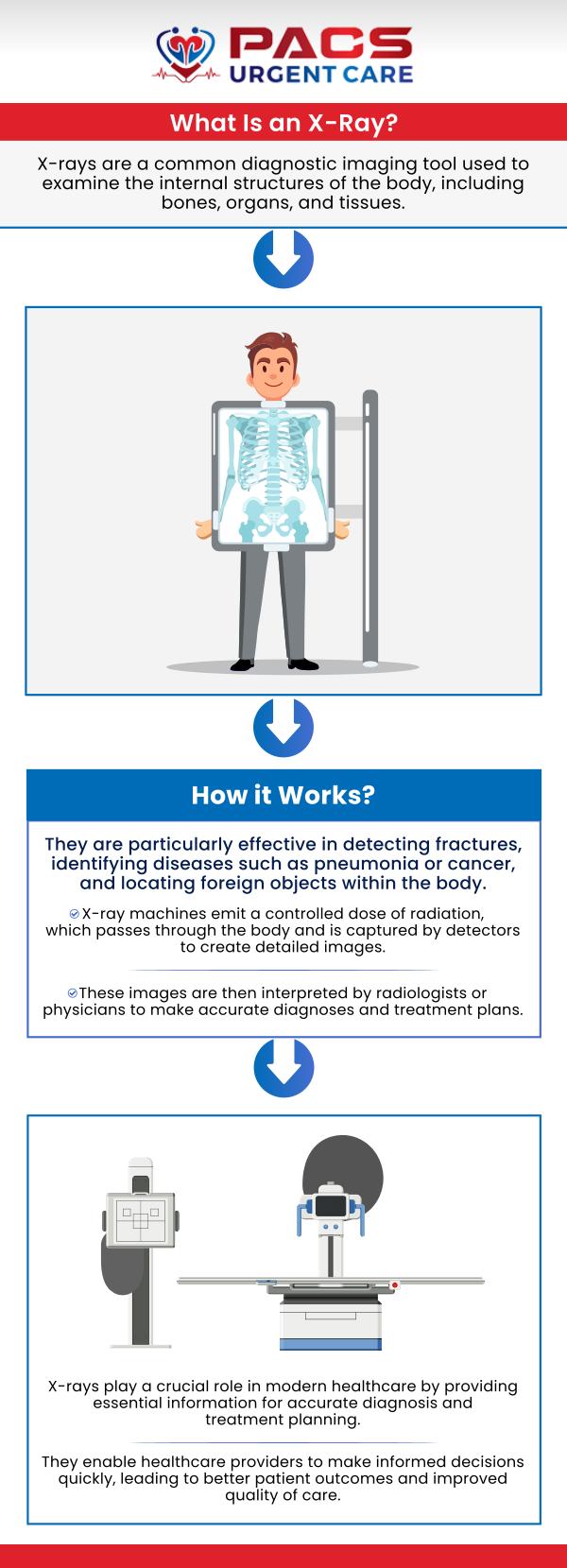 At PACS Urgent Care, Dr. Khaled Said MD, and Dr. Walid Hammad offer safe, professional, and prompt X-ray imaging to ensure you can move forward with the appropriate treatment. Our knowledgeable and experienced team is committed to getting you the answers you need without delay. For more information about our x-ray services or for any questions that you have, reach out to us. Or you can book an appointment or walk-in for a same-day visit and get seen by a member of our medical staff. We have convenient locations in Alexandria, VA, and  Ruther Glen VA.