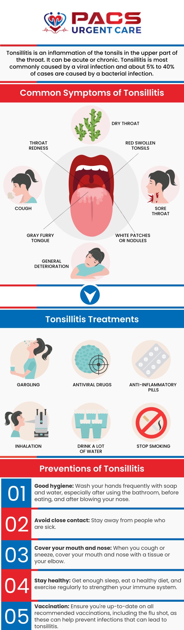 Treatment for tonsillitis will depend on what the cause is. PACS Urgent Care ensures that we find out the cause of your condition and provide the necessary treatment for tonsillitis. Some common symptoms of tonsillitis include high temperature, coughing, headache, earache, swollen painful lymph glands, and change of voice. At PACS Urgent Care, our medical professionals, Dr. Khaled Said MD and Dr. Walid Hammad offer treatment for tonsillitis. For more information, contact us today or schedule an appointment online. We have convenient locations to serve you in Alexandria VA, and Ruther Glen VA. Treatment for tonsillitis will depend on what the cause is. PACS Urgent Care ensures that we find out the cause of your condition and provide the necessary treatment for tonsillitis. Some common symptoms of tonsillitis include high temperature, coughing, headache, earache, swollen painful lymph glands, and change of voice. At PACS Urgent Care, our medical professionals, Dr. Khaled Said MD and Dr. Walid Hammad offer treatment for tonsillitis. For more information, contact us today or schedule an appointment online. We have convenient locations to serve you in Alexandria VA, and Ruther Glen VA.